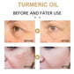 Turmeric Dark Spot Corrector Anti Aging Serum 30ml